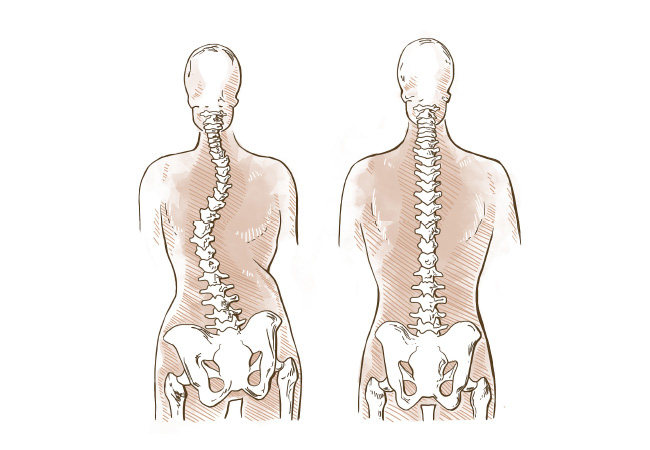 How To Find Relief From Sciatica